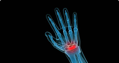 An image of a person's wrist where red indicates the pain area