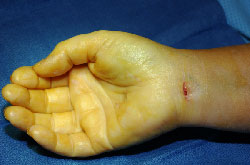 An image of a hand resting during operation with an indention at the wrist